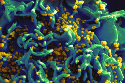 HIV